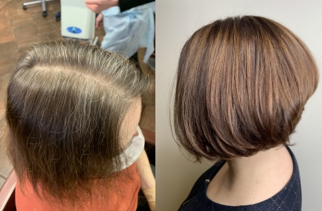 Микро мелирование волос фото на темные волосы фото до и после